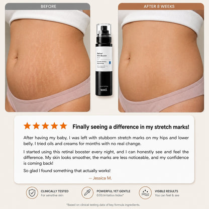 SOCI.™ Advanced Retinal Stretch Mark Serum