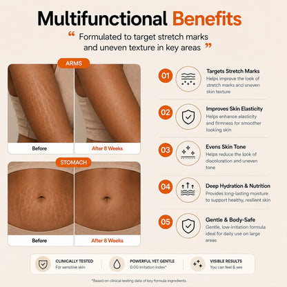 SOCI.™ Advanced Retinal Stretch Mark Serum